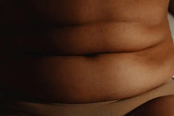 The Hidden Connection: How Stress Shapes Your Fitness and Body Composition 3 image of what stress can do on the stomach area and how Lipo 360 Folkestone can help to change your body shape.